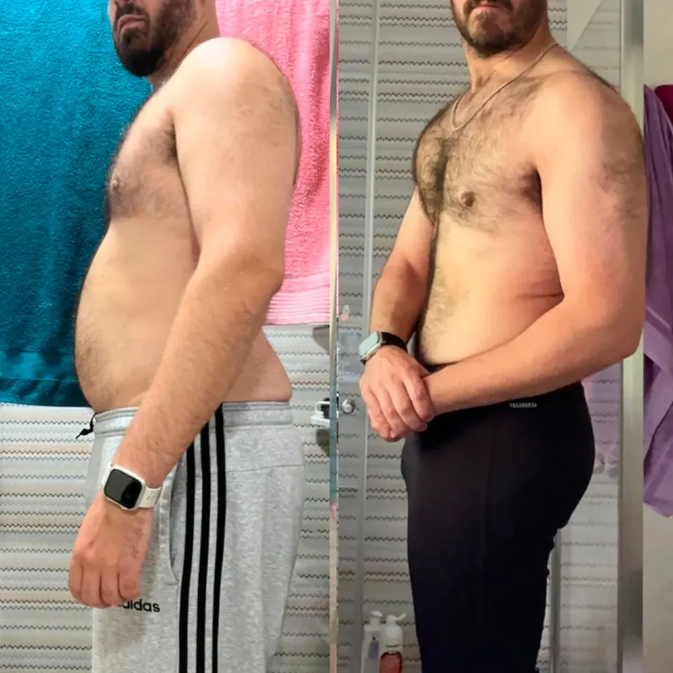 Fotos de antes y después de Jacob