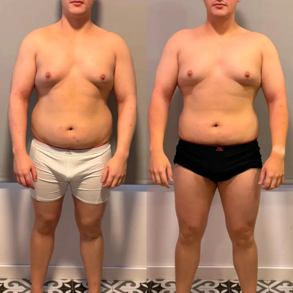 Fotos de antes y después de Pablo